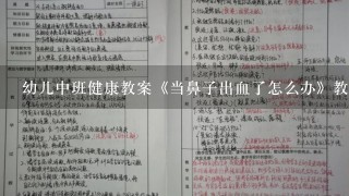 幼儿中班健康教案《当鼻子出血了怎么办》教学背景分析